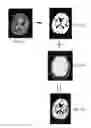 Fig. 02 - Method for volume evaluation of penumbra mismatch in acute ischemic stroke and system therefor