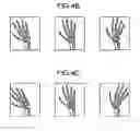 Fig. 05 - Medical image processing apparatus and method for medical image processing