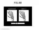 Fig. 11 - Medical image processing apparatus and method for medical image processing