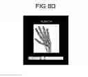 Fig. 13 - Medical image processing apparatus and method for medical image processing