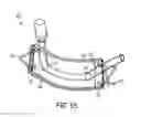 Fig. 53 - Flow meter and related system and apparatus