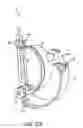 Fig. 57 - Flow meter and related system and apparatus