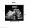 Fig. 10 - Ultrasound imaging apparatus and method of controlling the same