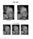 Fig. 14 - Ultrasound imaging apparatus and method of controlling the same