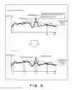 Fig. 11 - Signal processing apparatus, signal processing method, signal processing program