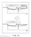 Fig. 14 - Signal processing apparatus, signal processing method, signal processing program