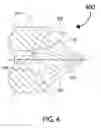 Fig. 05 - Triode hollow cathode electron gun for linear particle accelerators