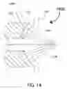 Fig. 15 - Triode hollow cathode electron gun for linear particle accelerators