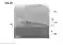 Fig. 14 - Silicon carbide semiconductor device