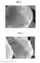 Fig. 03 - Anode active material for lithium secondary battery and preparation thereof