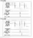 Fig. 21 - DRIVE CONTROL CIRCUIT FOR LINEAR VIBRATION MOTOR AND METHOD