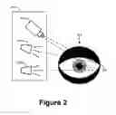 Fig. 04 - Image Capture Technique