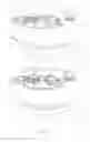 Fig. 04 - Method and apparatus for warning an obstacle of a vehicle