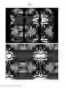 Fig. 06 - Plenoptic imaging device