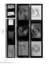 Fig. 13 - Plenoptic imaging device