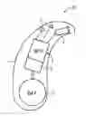 Fig. 01 - Method, device, and system for suppressing feedback in hearing aid devices with adaptive split-band frequency