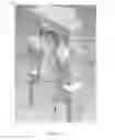 Fig. 03 - Biological sample vitrification carrier and usage thereof
