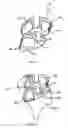 Fig. 02 - Personal protective system