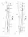 Fig. 04 - Article of footwear with soil-shedding performance