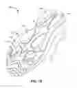 Fig. 16 - Article of footwear with soil-shedding performance