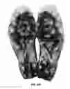 Fig. 18 - Article of footwear with soil-shedding performance