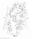 Fig. 07 - Medial rotational traction element arrangement for an article of footwear