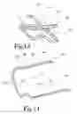 Fig. 09 - Hair lifting, retention, and styling device including accessories