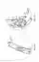 Fig. 29 - INFANT-SUPPORTING DEVICES