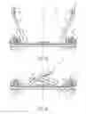 Fig. 37 - INFANT-SUPPORTING DEVICES
