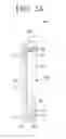 Fig. 05 - Supporter and vacuum cleaner having the same