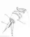 Fig. 01 - Cautery