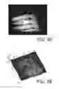 Fig. 09 - Image capturing system and electronic endoscope system