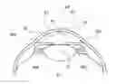 Fig. 01 - System for calculating center of anterior capsule and method thereof