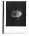 Fig. 04 - Three dimensional tissue imaging system and method