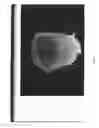 Fig. 06 - Three dimensional tissue imaging system and method