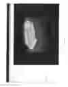 Fig. 11 - Three dimensional tissue imaging system and method