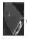 Fig. 13 - Three dimensional tissue imaging system and method