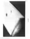Fig. 14 - Three dimensional tissue imaging system and method