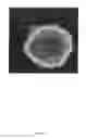 Fig. 17 - Three dimensional tissue imaging system and method