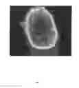 Fig. 19 - Three dimensional tissue imaging system and method