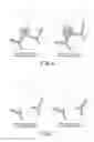 Fig. 05 - Medical image processing apparatus and medical image processing method