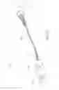 Fig. 15 - SYSTEMS AND METHODS FOR LOCATING AND/OR CHARACTERIZING INTRAGASTRIC DEVICES