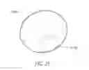 Fig. 30 - SYSTEMS AND METHODS FOR LOCATING AND/OR CHARACTERIZING INTRAGASTRIC DEVICES