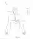 Fig. 66 - SYSTEMS AND METHODS FOR LOCATING AND/OR CHARACTERIZING INTRAGASTRIC DEVICES