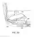 Fig. 03 - Displays for a medical device