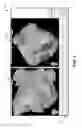 Fig. 04 - Signal characterization to facilitate therapy delivery