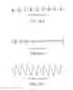 Fig. 29 - ELECTRONIC DEVICE AND METHOD FOR MEASURING VITAL SIGNAL