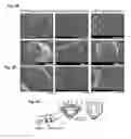 Fig. 03 - Methods of testing for allergen sensitivity