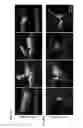 Fig. 07 - Methods of testing for allergen sensitivity