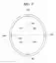 Fig. 10 - Method for densitometric analysis of computed tomography image
